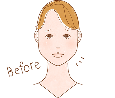 バッカルファットを除去するだけだと