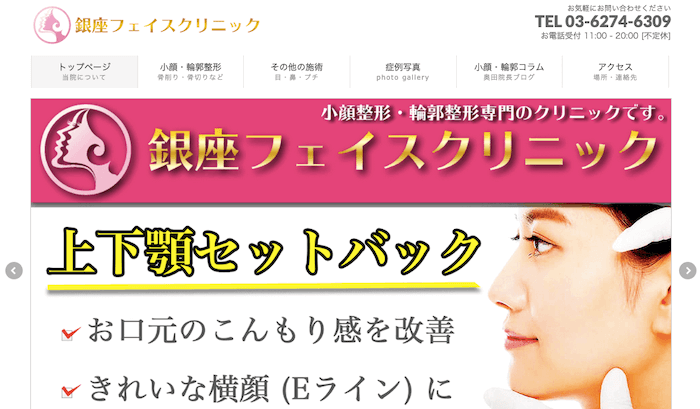 銀座フェイスクリニック公式HPキャプチャ